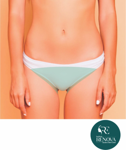 Virilha Completa + Perianal Feminino