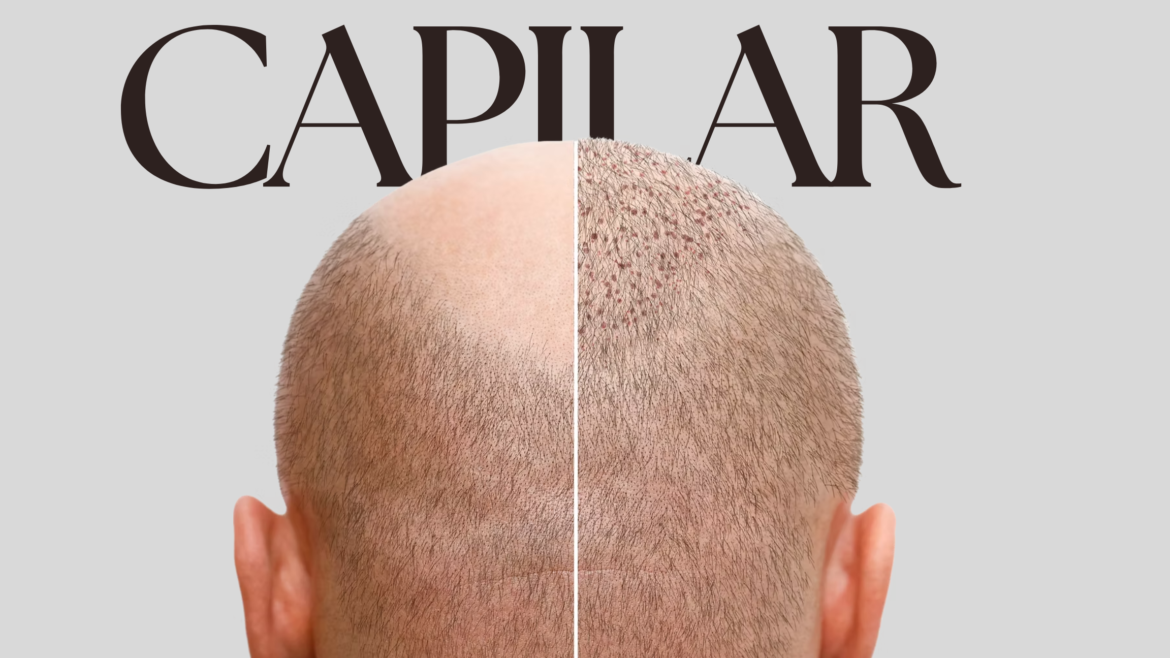Tratamento Capilar